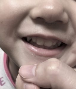 奥歯が生えそろう3歳前。何を食べさせればいい？？