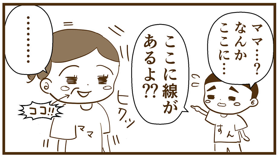 ほうれい線を指すすん