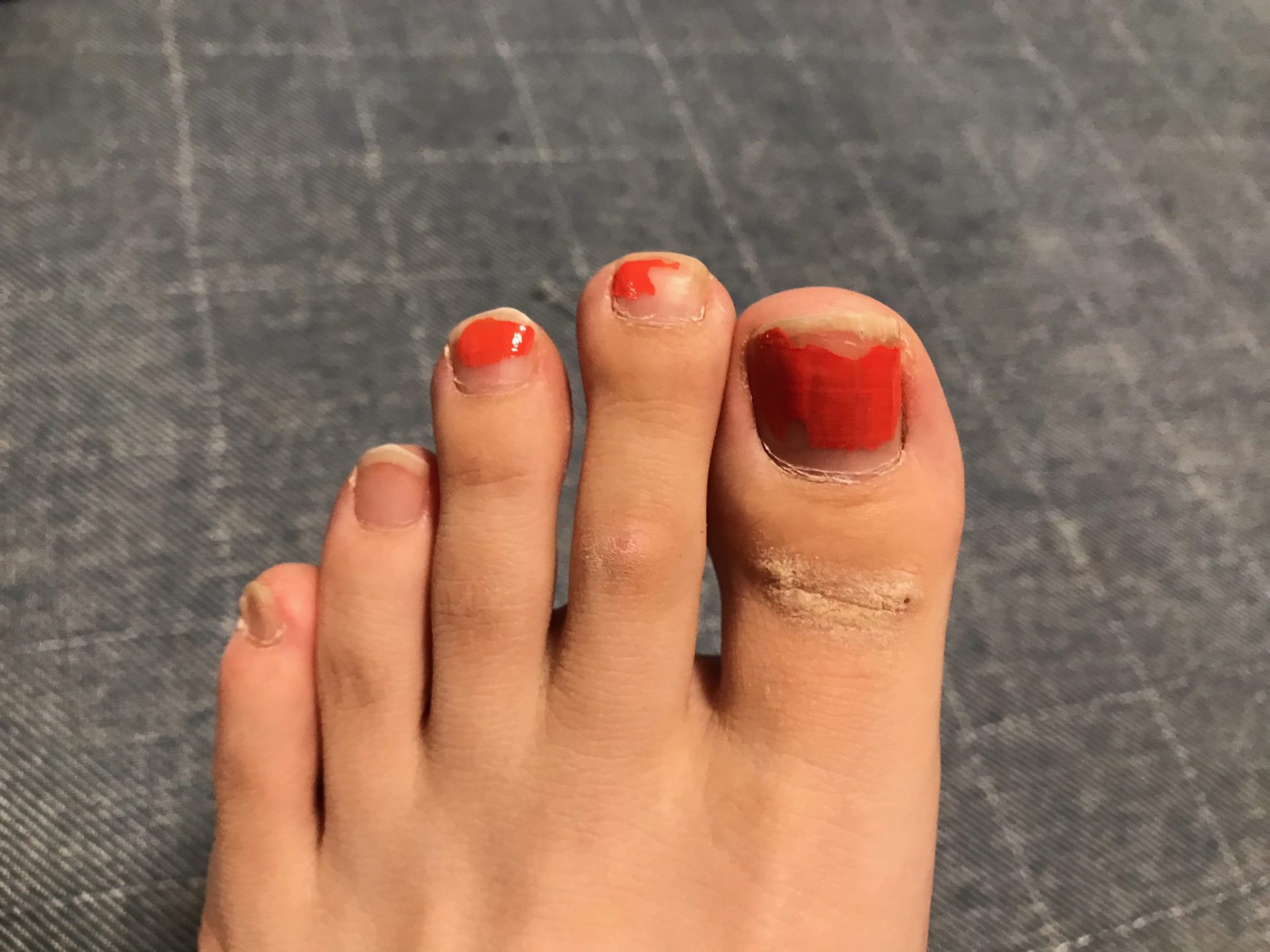 マニキュアボロボロな足