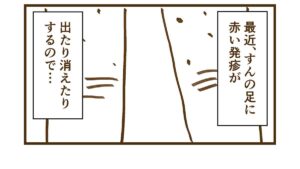発疹の原因は夏バテ！？【すんの足に蕁麻疹が出来たので病院に行ってきました】